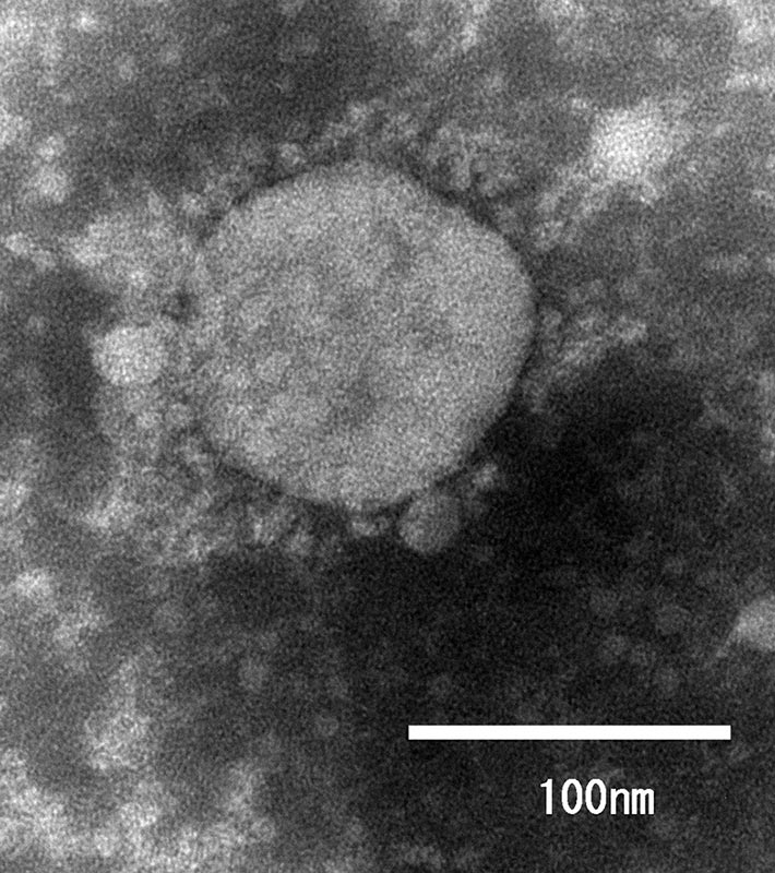 سلالة فيروس كورونا الجديدة تحت المجهر الإلكتروني | عبر المعهد الوطني الياباني للأمراض المُعدية