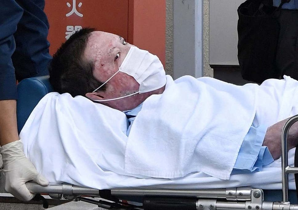 شينجي أوبا بعد خروجه من المستشفى | عبر رويترز
