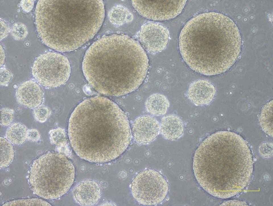 خلايا مستخلصة من خلايا جذعية ستنمو لاحقاً لخلايا عصبية داخل الحبل الشوكي | صورة من جامعة كيئو و وكالة كيودو