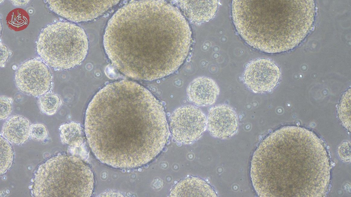 جامعة كيئو تبدأ أول تجربة في العالم لعلاج الحبل الشوكي بالخلايا الجذعية